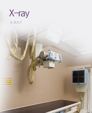 X-ray - X-ray