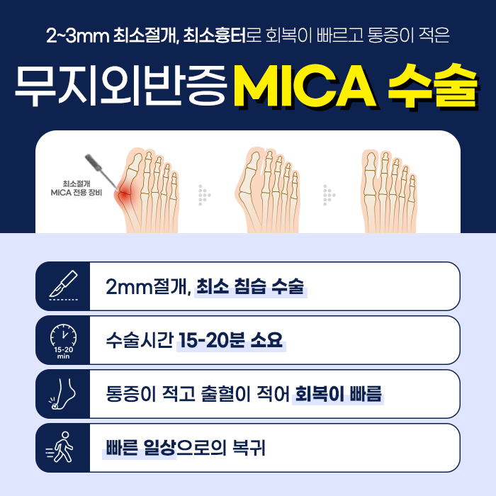 MICA수술